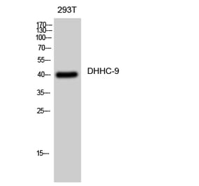 Western blot - DHHC-9 Polyclonal Antibody from Signalway Antibody (40841) - Antibodies.com