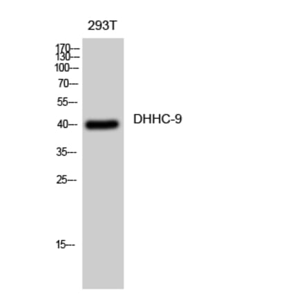 Western blot - DHHC-9 Polyclonal Antibody from Signalway Antibody (40841) - Antibodies.com