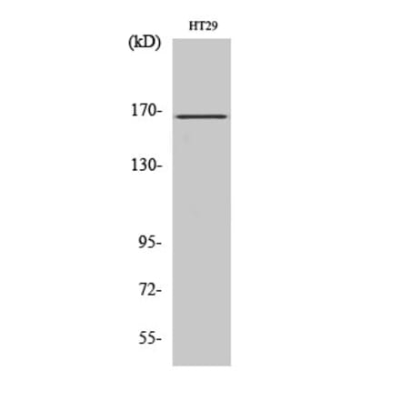 Western blot - FANCD2 Polyclonal Antibody from Signalway Antibody (40920) - Antibodies.com