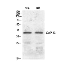 Western blot - GAP-43 Polyclonal Antibody from Signalway Antibody (40949) - Antibodies.com