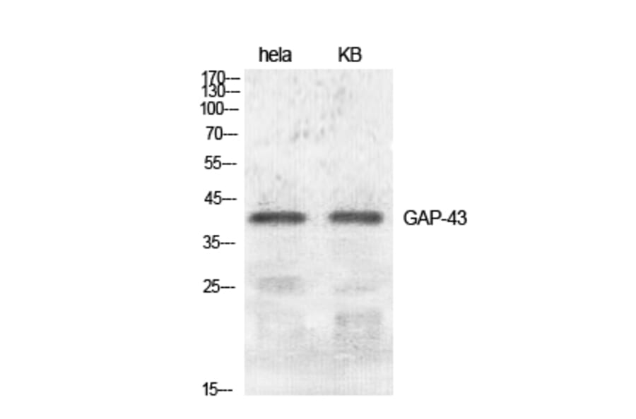 Western blot - GAP-43 Polyclonal Antibody from Signalway Antibody (40949) - Antibodies.com