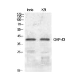 Western blot - GAP-43 Polyclonal Antibody from Signalway Antibody (40949) - Antibodies.com