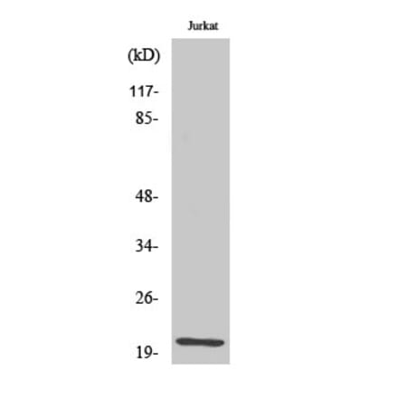 Western blot - HEN1/2 Polyclonal Antibody from Signalway Antibody (41002) - Antibodies.com