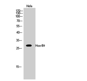 Western blot - Hox-B9 Polyclonal Antibody from Signalway Antibody (41031) - Antibodies.com