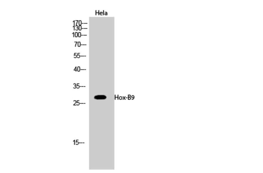 Western blot - Hox-B9 Polyclonal Antibody from Signalway Antibody (41031) - Antibodies.com