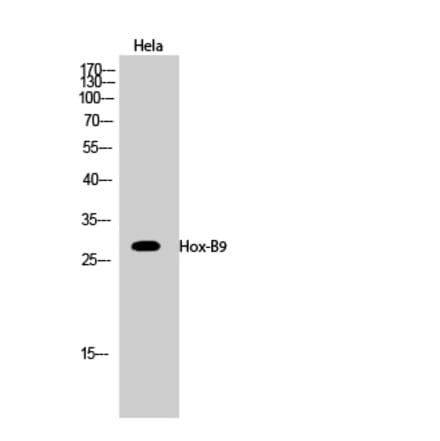 Western blot - Hox-B9 Polyclonal Antibody from Signalway Antibody (41031) - Antibodies.com