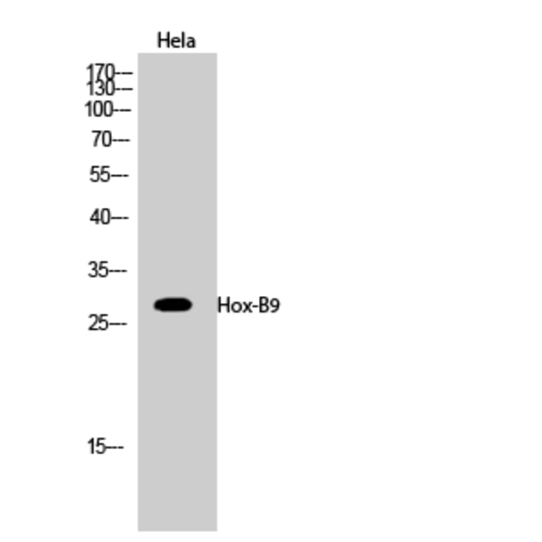 Western blot - Hox-B9 Polyclonal Antibody from Signalway Antibody (41031) - Antibodies.com