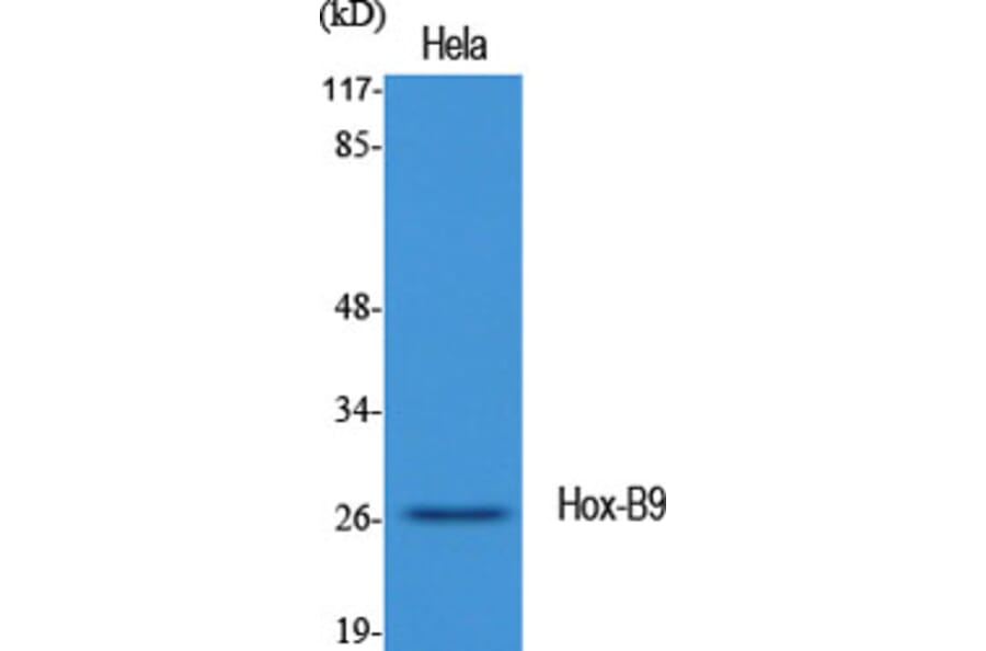 Western blot - Hox-B9 Polyclonal Antibody from Signalway Antibody (41031) - Antibodies.com
