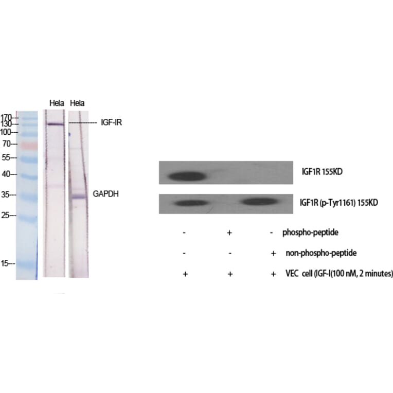 Western blot - IGF-IR Polyclonal Antibody from Signalway Antibody (41053) - Antibodies.com