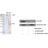 Western blot - IGF-IR Polyclonal Antibody from Signalway Antibody (41053) - Antibodies.com
