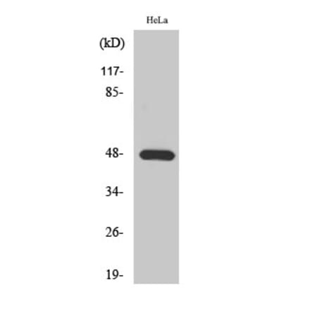 Western blot - KIR2.1 Polyclonal Antibody from Signalway Antibody (41093) - Antibodies.com