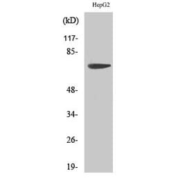 Western blot - MMP-16 Polyclonal Antibody from Signalway Antibody (41186) - Antibodies.com