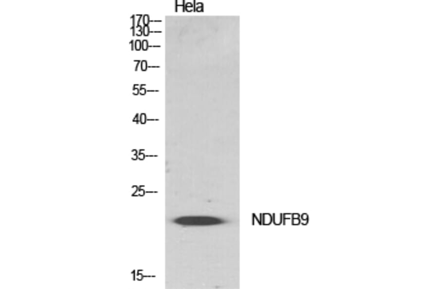 Western blot - NDUFB9 Polyclonal Antibody from Signalway Antibody (41208) - Antibodies.com