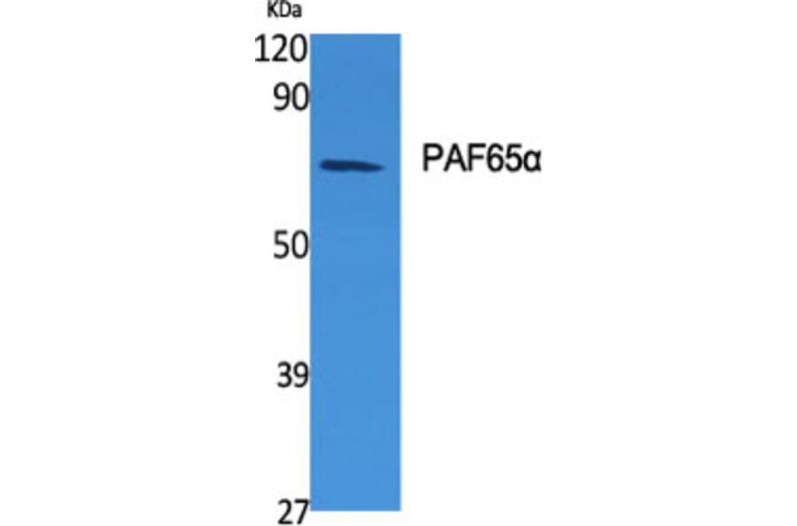 Western blot - PAF65α Polyclonal Antibody from Signalway Antibody (41320) - Antibodies.com