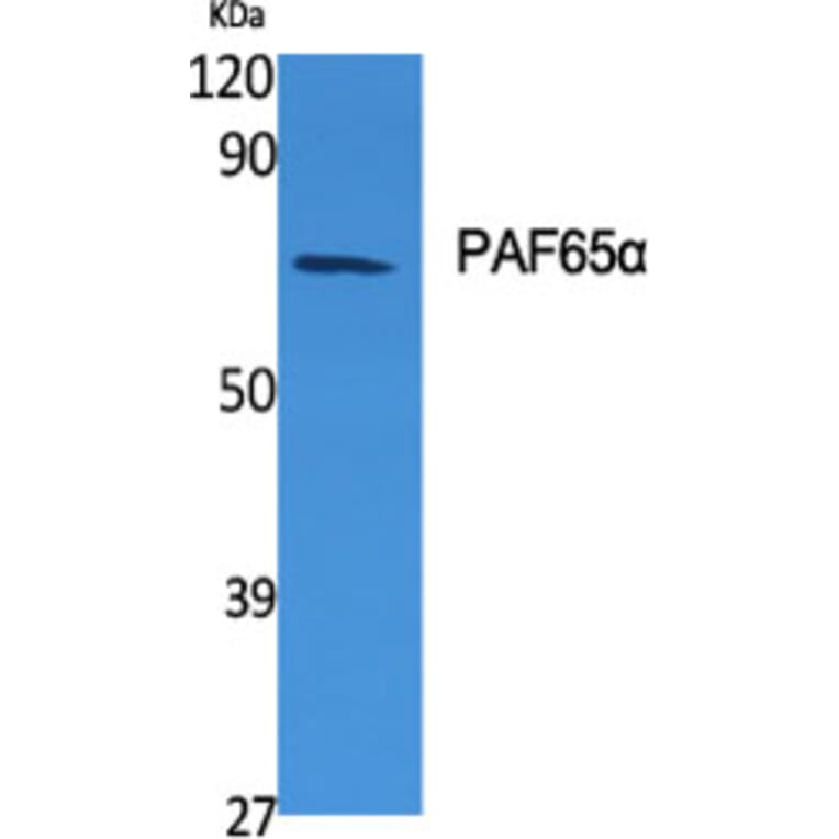 Western blot - PAF65α Polyclonal Antibody from Signalway Antibody (41320) - Antibodies.com