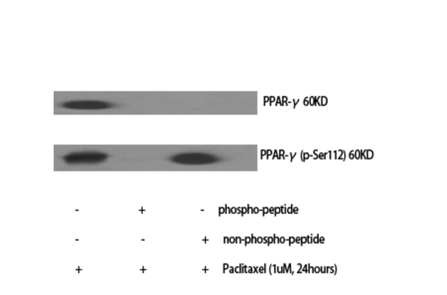 Western blot - PPAR-γ Polyclonal Antibody from Signalway Antibody (41360) - Antibodies.com