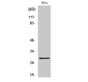 Western blot - Rab 20 Polyclonal Antibody from Signalway Antibody (41375) - Antibodies.com
