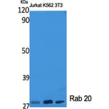 Western blot - Rab 20 Polyclonal Antibody from Signalway Antibody (41375) - Antibodies.com