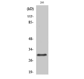 Western blot - Rab 34 Polyclonal Antibody from Signalway Antibody (41377) - Antibodies.com