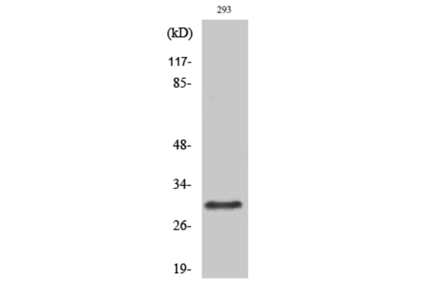 Western blot - Rab 34 Polyclonal Antibody from Signalway Antibody (41377) - Antibodies.com