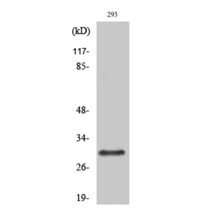 Western blot - Rab 34 Polyclonal Antibody from Signalway Antibody (41377) - Antibodies.com