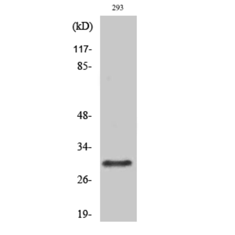 Western blot - Rab 34 Polyclonal Antibody from Signalway Antibody (41377) - Antibodies.com