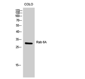 Western blot - Rab 6A Polyclonal Antibody from Signalway Antibody (41378) - Antibodies.com