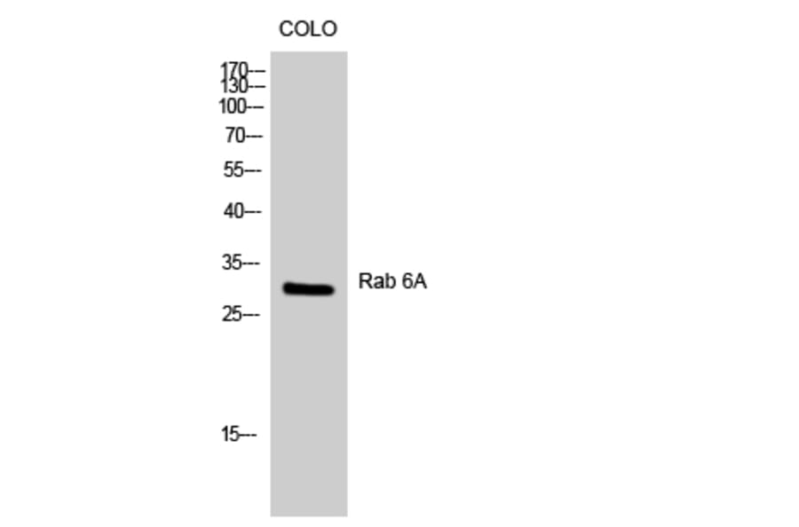 Western blot - Rab 6A Polyclonal Antibody from Signalway Antibody (41378) - Antibodies.com