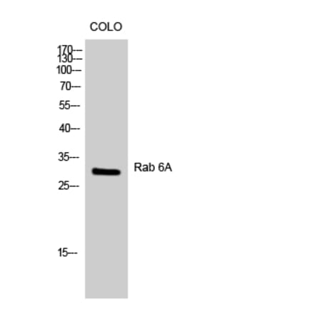 Western blot - Rab 6A Polyclonal Antibody from Signalway Antibody (41378) - Antibodies.com