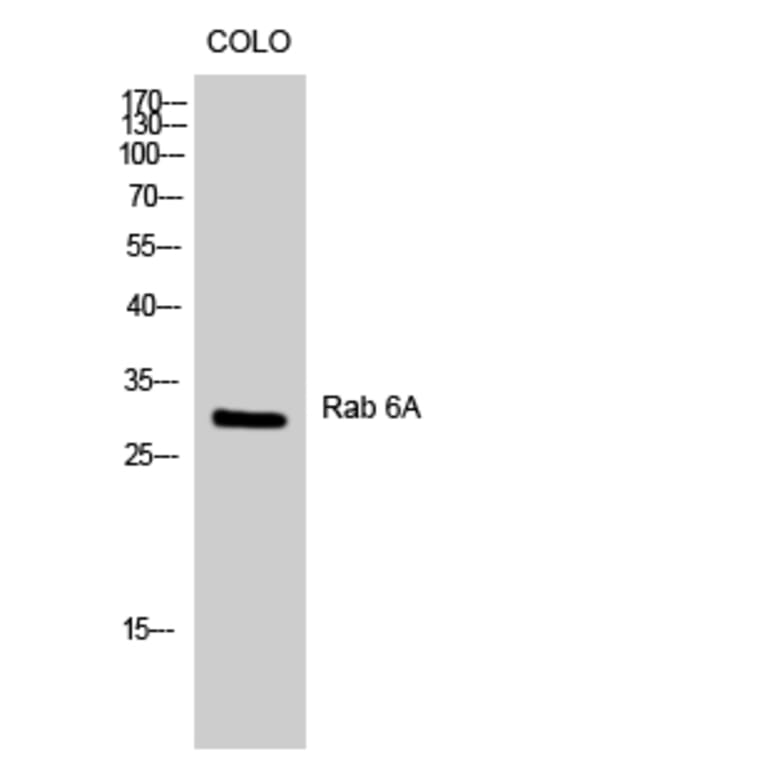 Western blot - Rab 6A Polyclonal Antibody from Signalway Antibody (41378) - Antibodies.com