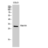 Western blot - Rab 6A Polyclonal Antibody from Signalway Antibody (41378) - Antibodies.com