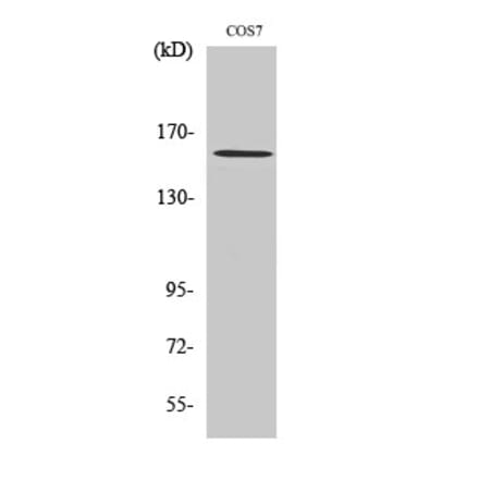 Western blot - Rock-1 Polyclonal Antibody from Signalway Antibody (41414) - Antibodies.com