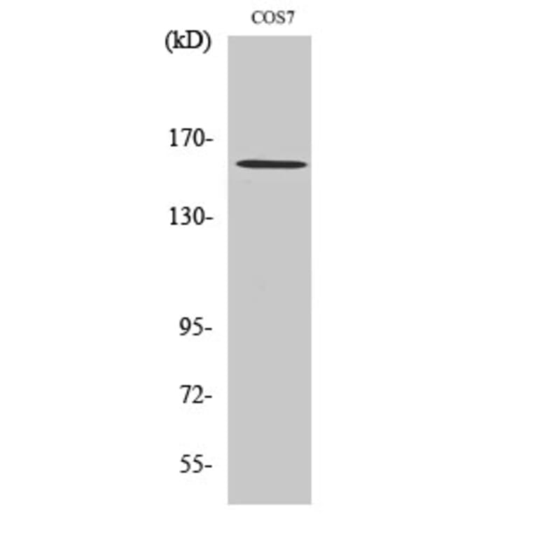 Western blot - Rock-1 Polyclonal Antibody from Signalway Antibody (41414) - Antibodies.com