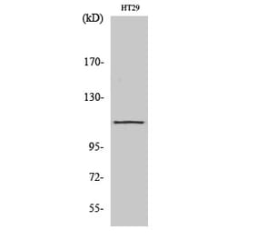 Western blot - SERCA1 Polyclonal Antibody from Signalway Antibody (41428) - Antibodies.com