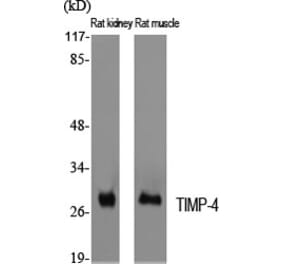 Western blot - TIMP-4 Polyclonal Antibody from Signalway Antibody (41502) - Antibodies.com