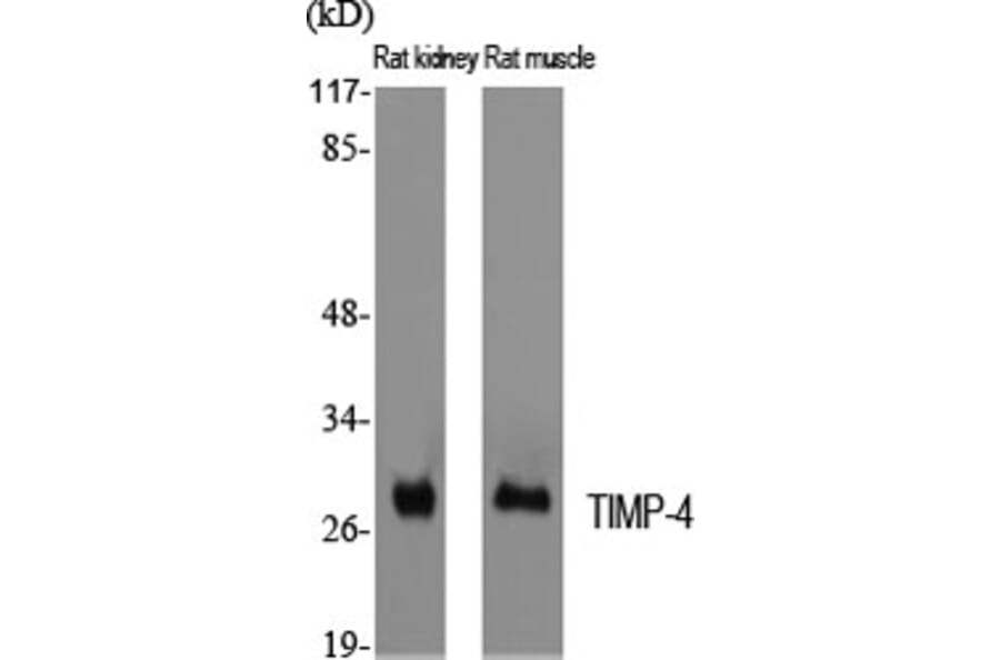 Western blot - TIMP-4 Polyclonal Antibody from Signalway Antibody (41502) - Antibodies.com
