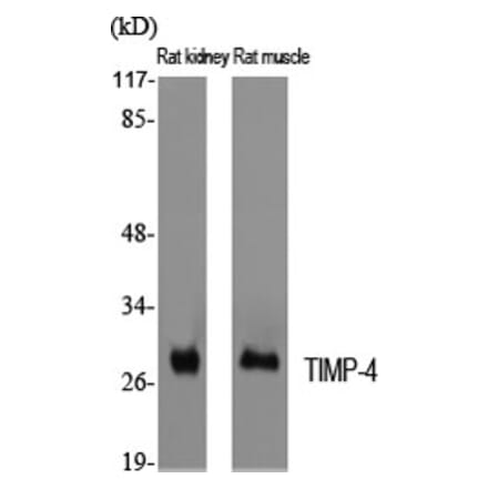 Western blot - TIMP-4 Polyclonal Antibody from Signalway Antibody (41502) - Antibodies.com