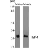 Western blot - TIMP-4 Polyclonal Antibody from Signalway Antibody (41502) - Antibodies.com