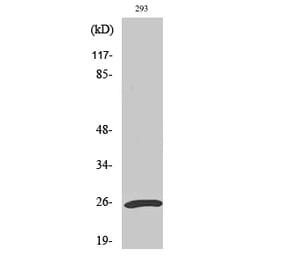 Western blot - UCH-L1 Polyclonal Antibody from Signalway Antibody (41522) - Antibodies.com