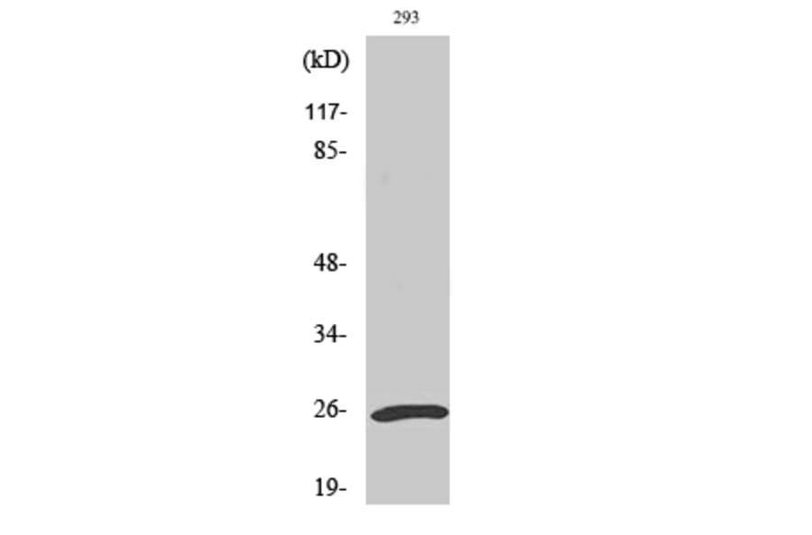 Western blot - UCH-L1 Polyclonal Antibody from Signalway Antibody (41522) - Antibodies.com