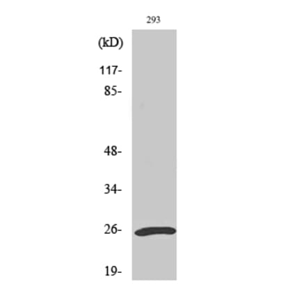 Western blot - UCH-L1 Polyclonal Antibody from Signalway Antibody (41522) - Antibodies.com