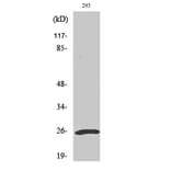 Western blot - UCH-L1 Polyclonal Antibody from Signalway Antibody (41522) - Antibodies.com
