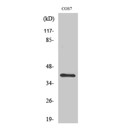 Western blot - ZNF134 Polyclonal Antibody from Signalway Antibody (41542) - Antibodies.com