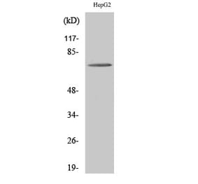 Western blot - ABCD4 Polyclonal Antibody from Signalway Antibody (40536) - Antibodies.com