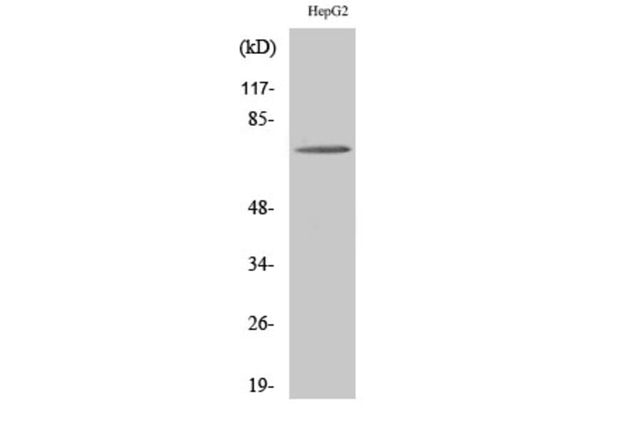 Western blot - ABCD4 Polyclonal Antibody from Signalway Antibody (40536) - Antibodies.com