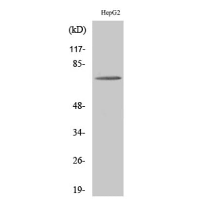 Western blot - ABCD4 Polyclonal Antibody from Signalway Antibody (40536) - Antibodies.com