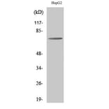 Western blot - ABCD4 Polyclonal Antibody from Signalway Antibody (40536) - Antibodies.com