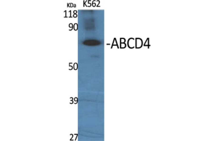 Western blot - ABCD4 Polyclonal Antibody from Signalway Antibody (40536) - Antibodies.com