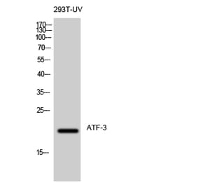 Western blot - ATF-3 Polyclonal Antibody from Signalway Antibody (40625) - Antibodies.com