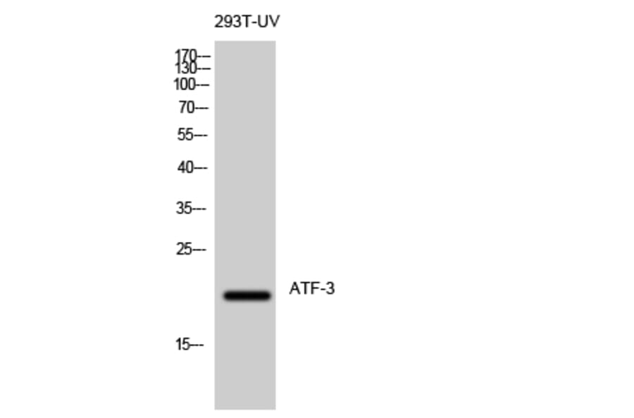 Western blot - ATF-3 Polyclonal Antibody from Signalway Antibody (40625) - Antibodies.com